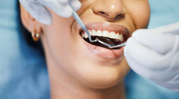 Best Emergency Dental Care for Broken or Chipped Teeth in , OK